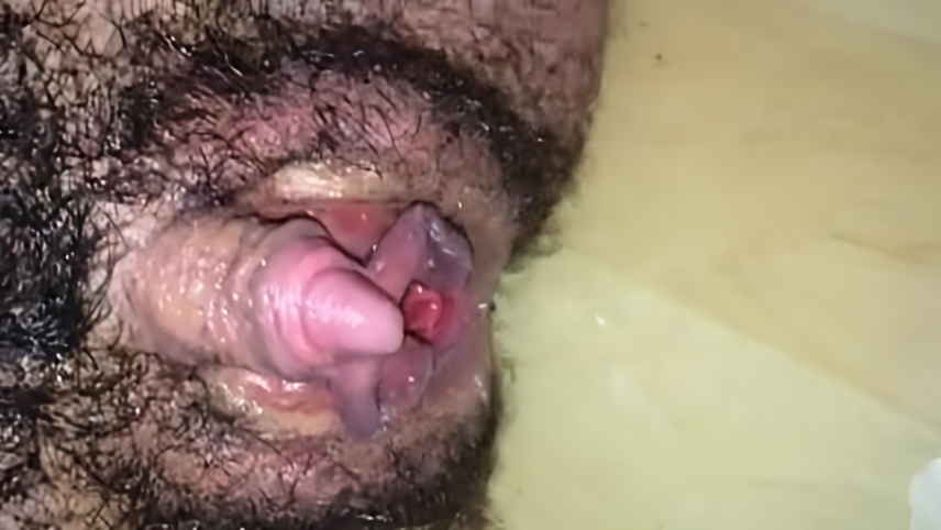 Big clit hairy