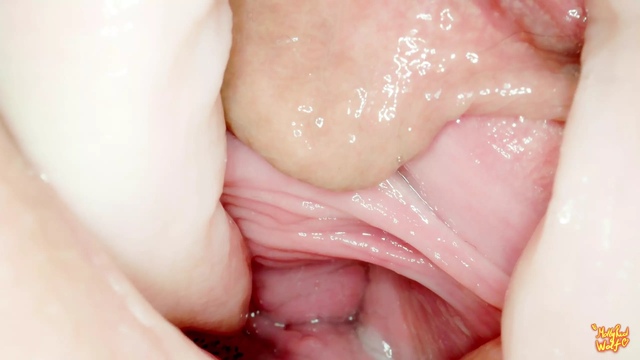 Hey Stepbrother! Let's Play Gynecologist? Gyno, Endoscopy - Mollyredwolf